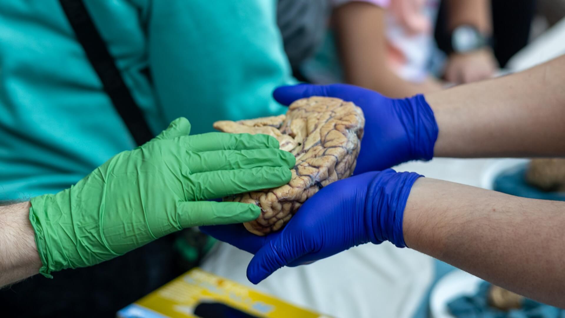Researchers in colored gloves examining a brain model during scientific demonstration