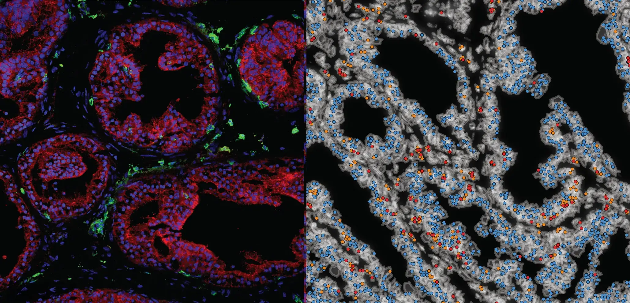 Fluorescent microscopy showing tissue cells with colored markers overlaid on grayscale anatomical structure.