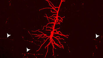 Bright red branching neural network or blood vessel structure on dark background