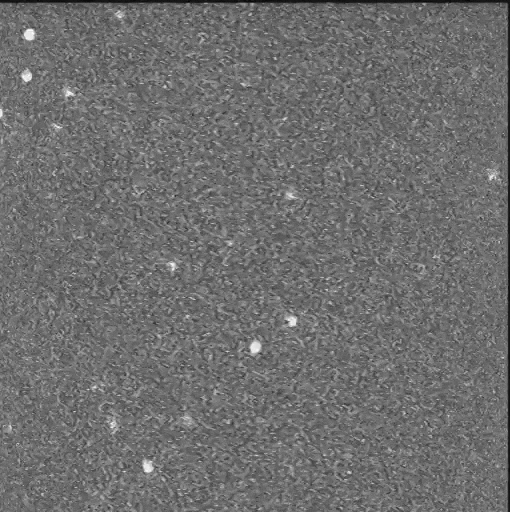 Grayscale image showing white dots scattered across textured gray background