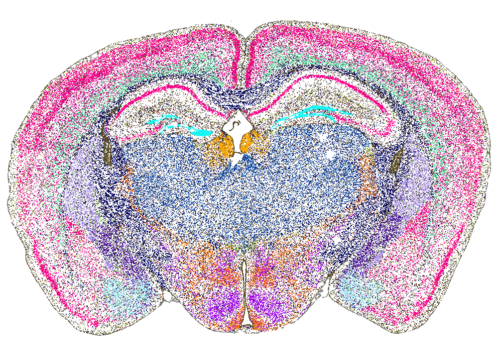 Colorful cross-section of brain showing different regions with pink, blue, and purple dotted patterns.