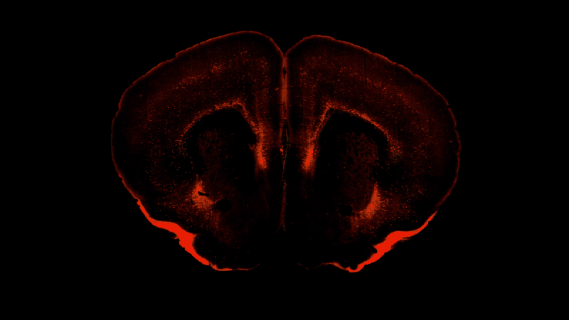 Red-orange glowing brain scan or cross-section on black background