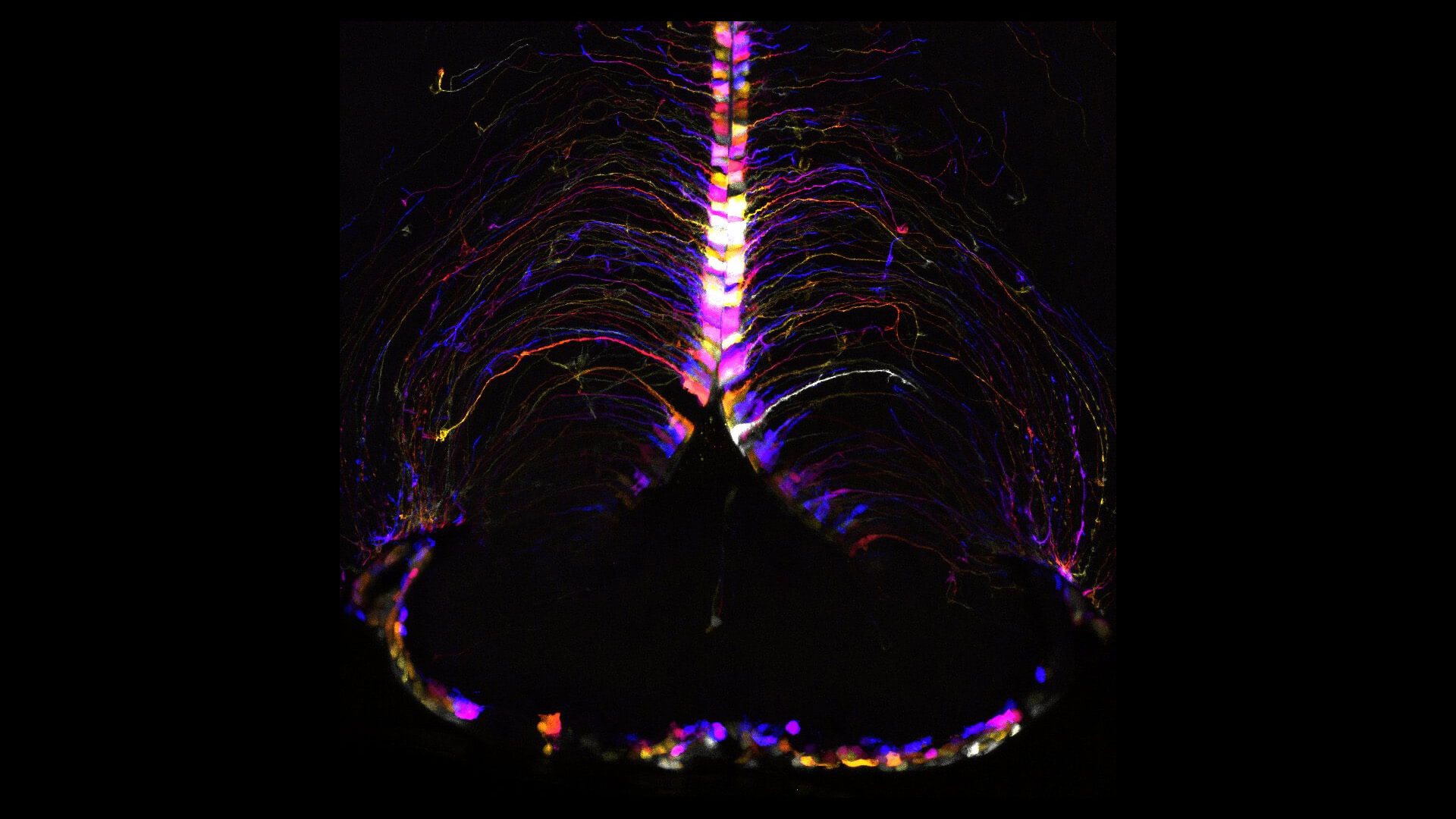 Colorful medical brain scan showing neural pathways with vibrant purple, yellow, and blue fluorescent imaging.