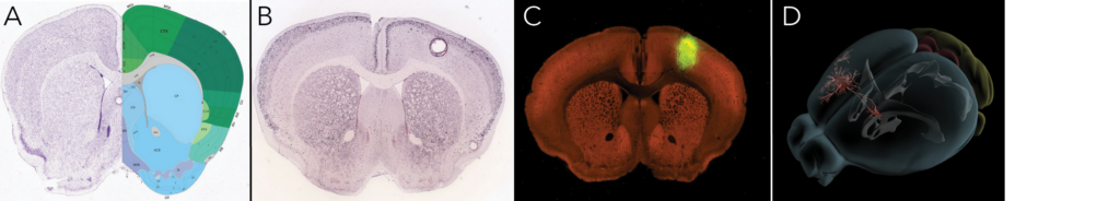 Figure 1: Calbindin expression patterns and projection of calbindin-expressing neurons