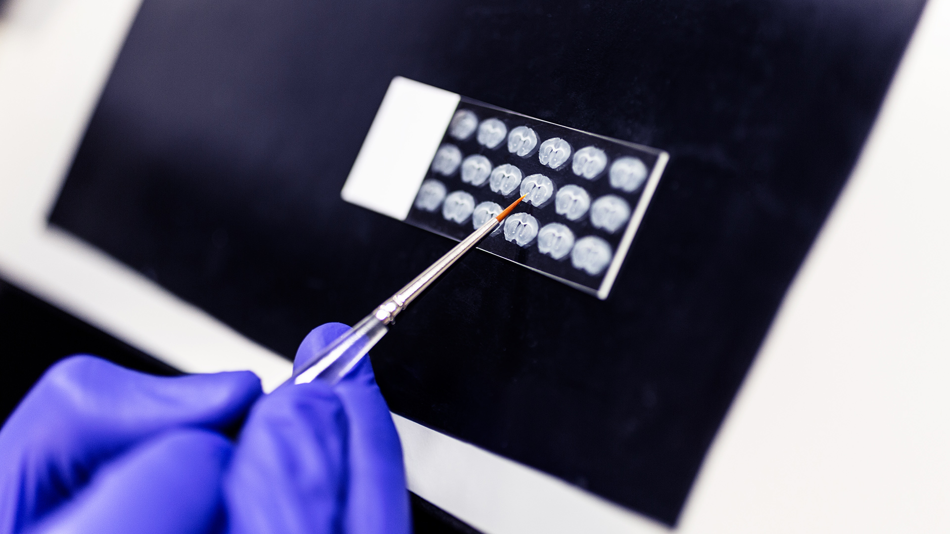 Scientist holding brush pointing at chest X-ray images on dark background