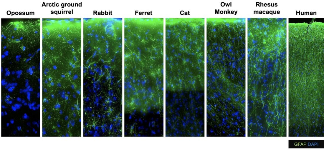 Fluorescence microscopy comparison of GFAP protein expression across eight species: opossum, Arctic ground squirrel, rabbit, ferret, cat, owl monkey, rhesus macaque, and human.