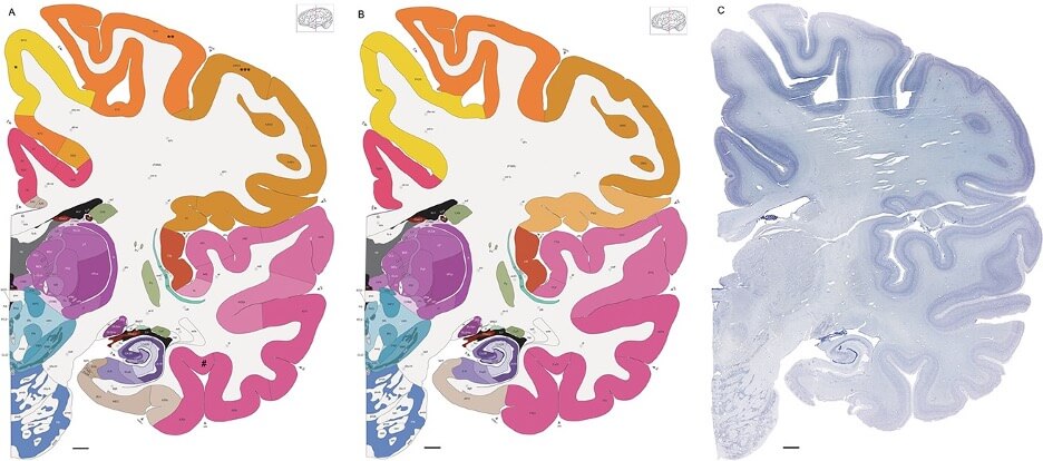Colorful brain cross-section diagrams showing anatomical regions in orange, pink, and yellow.