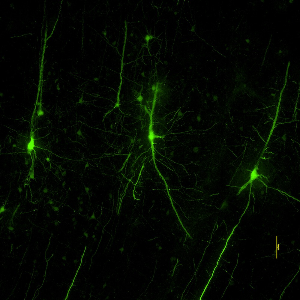 Fluorescent green neurons with branching dendrites against black background