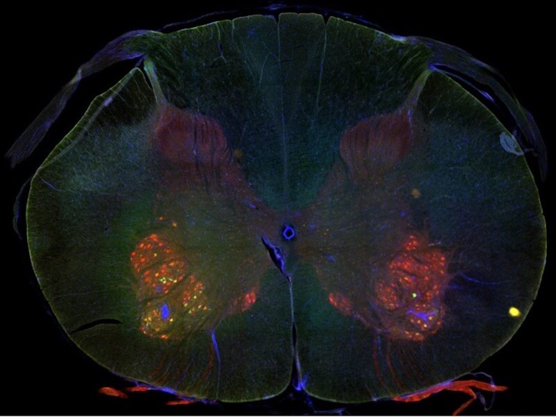 Cross-section of brain tissue with fluorescent staining showing neural structures and activity in different regions.