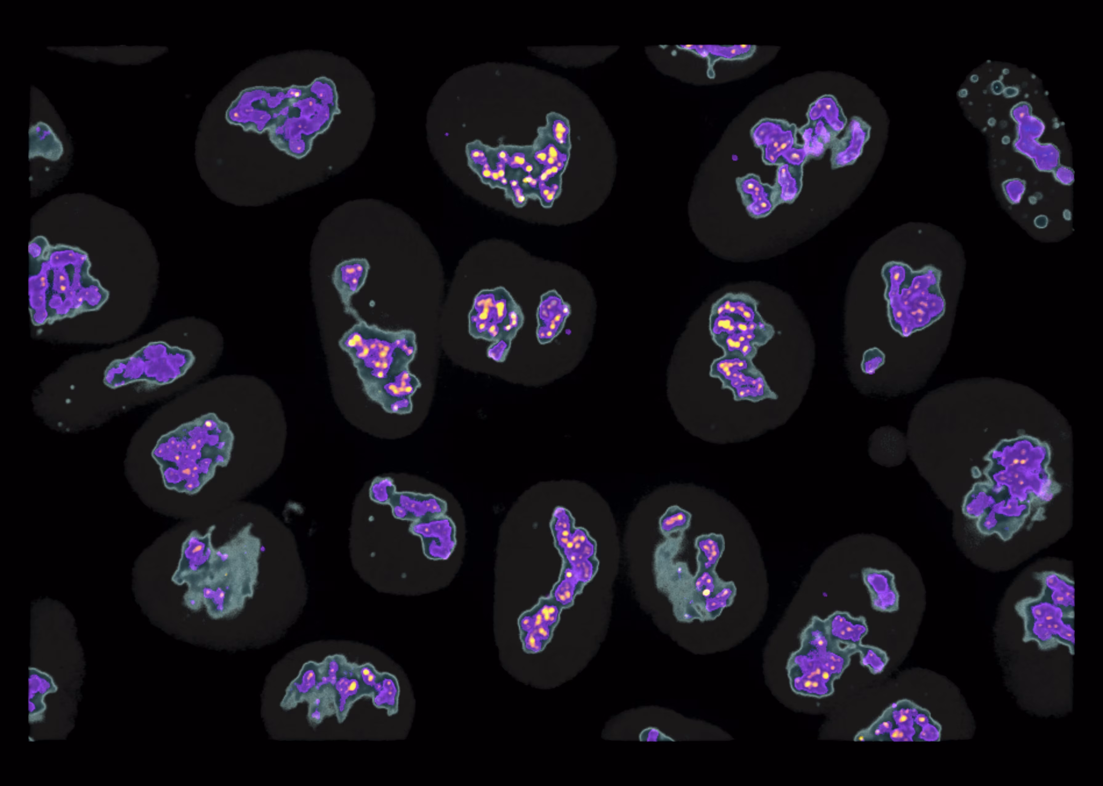 Medical scan showing multiple cells with purple and yellow fluorescent markers on black background