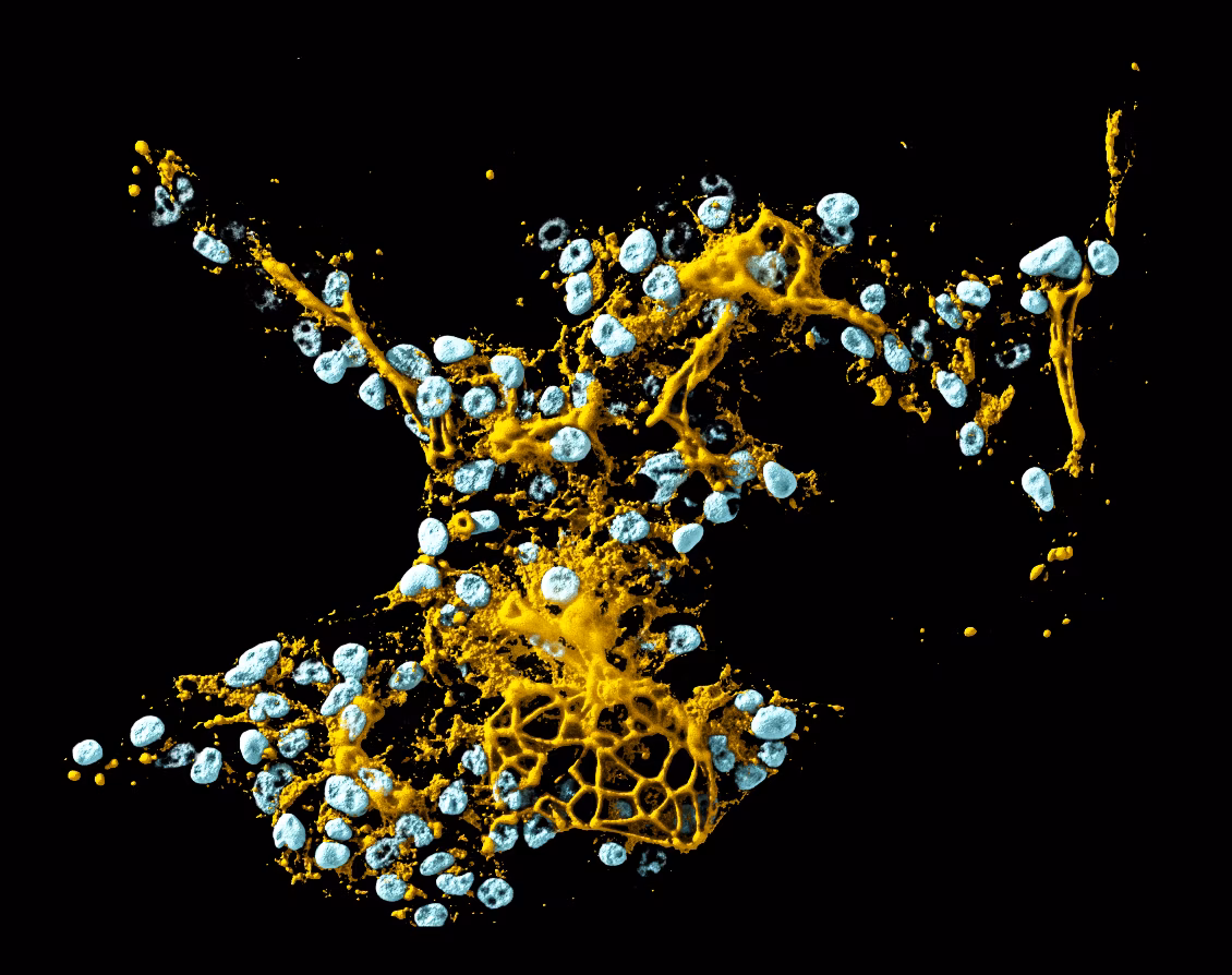 Yellow mycelium network with blue spherical particles on black background
