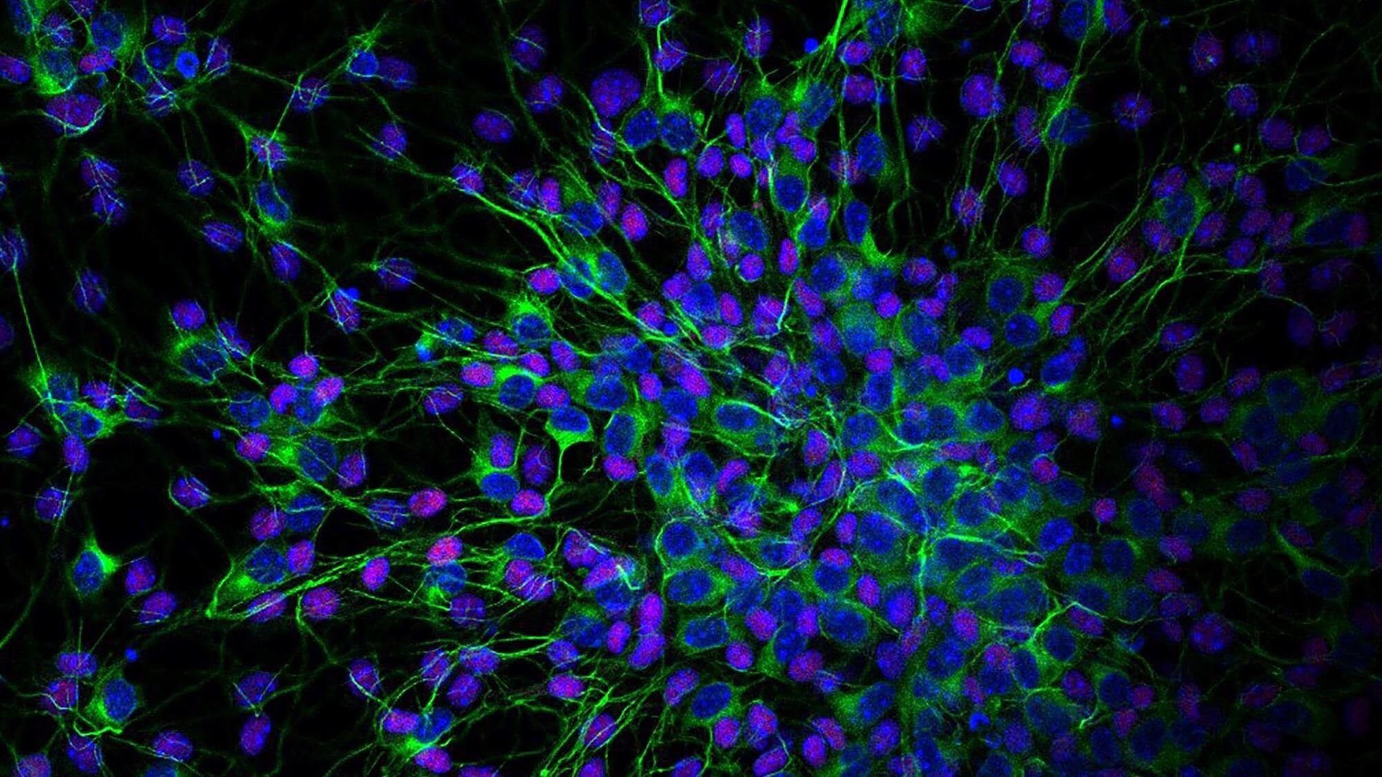 Fluorescent microscopy image showing neurons with green filaments and blue purple cell nuclei