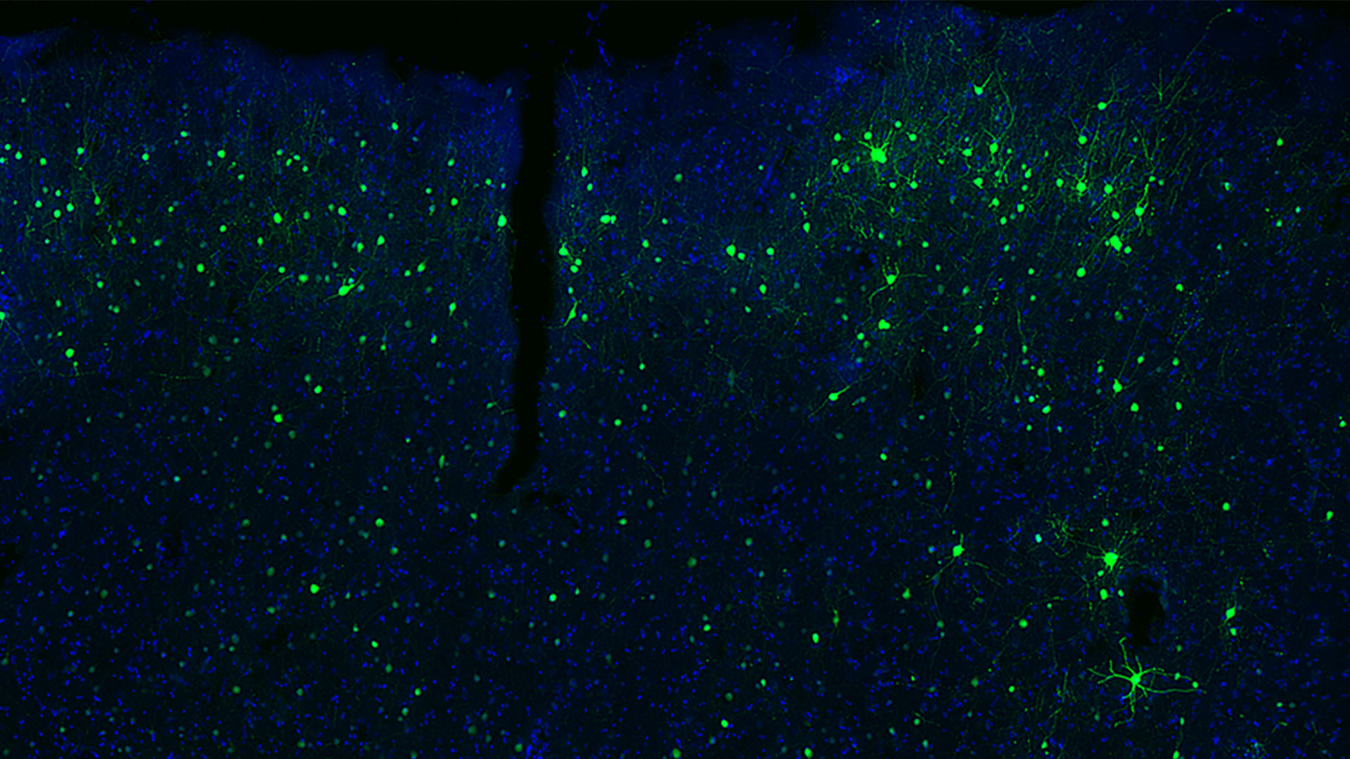 Fluorescent microscopy image showing green neurons and blue background in brain tissue