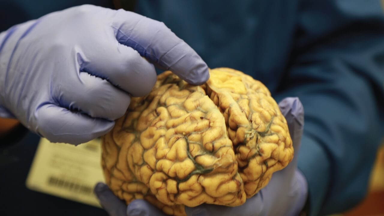 Gloved hand holding a yellow brain model for medical or educational examination.