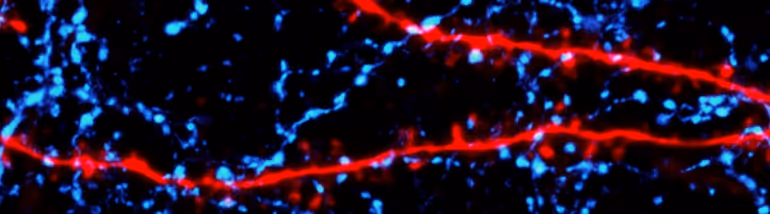 Microscopic image showing red neural fibers intertwined with blue-stained cells on a black background.
