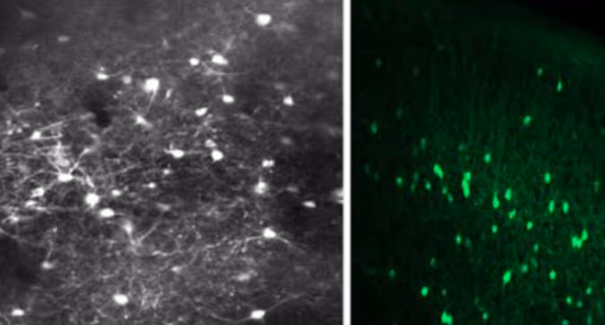 Fluorescence images of neurons