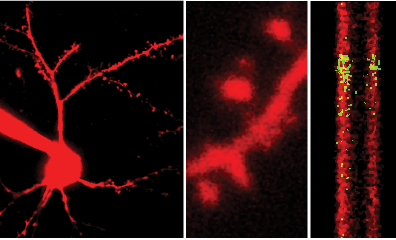 image of neuronal dendrite