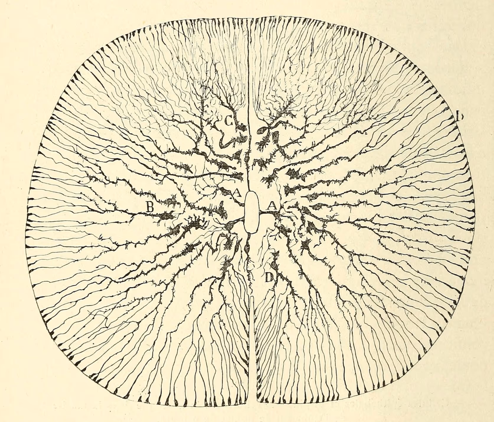 Boltzmann Brains — 2. Solipsism in a Lonely Cosmos