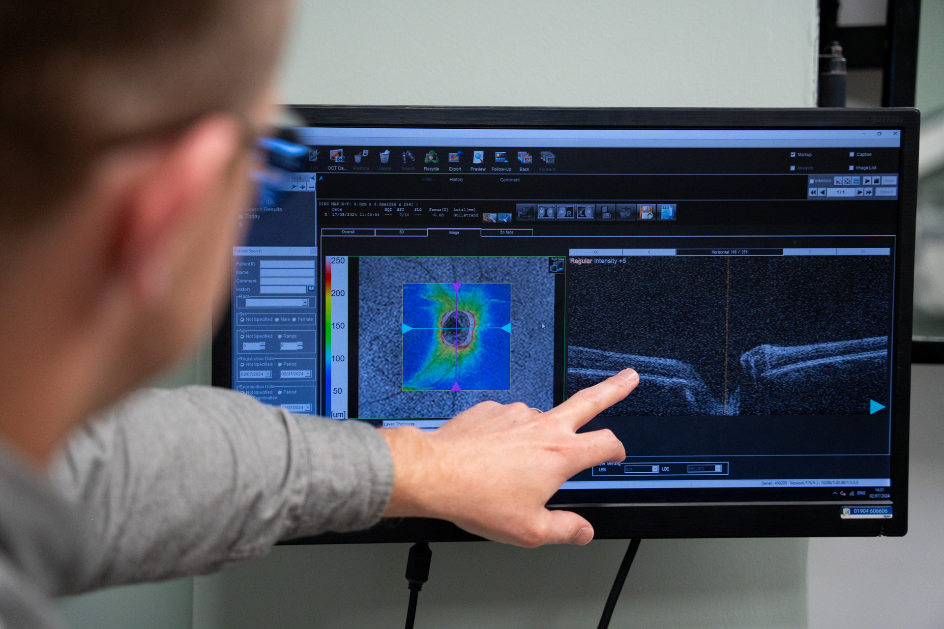 Person wearing glasses pointing at a computer screen showing detailed medical imaging and data, likely eye scan results with color-coded analysis and grayscale cross-sections.