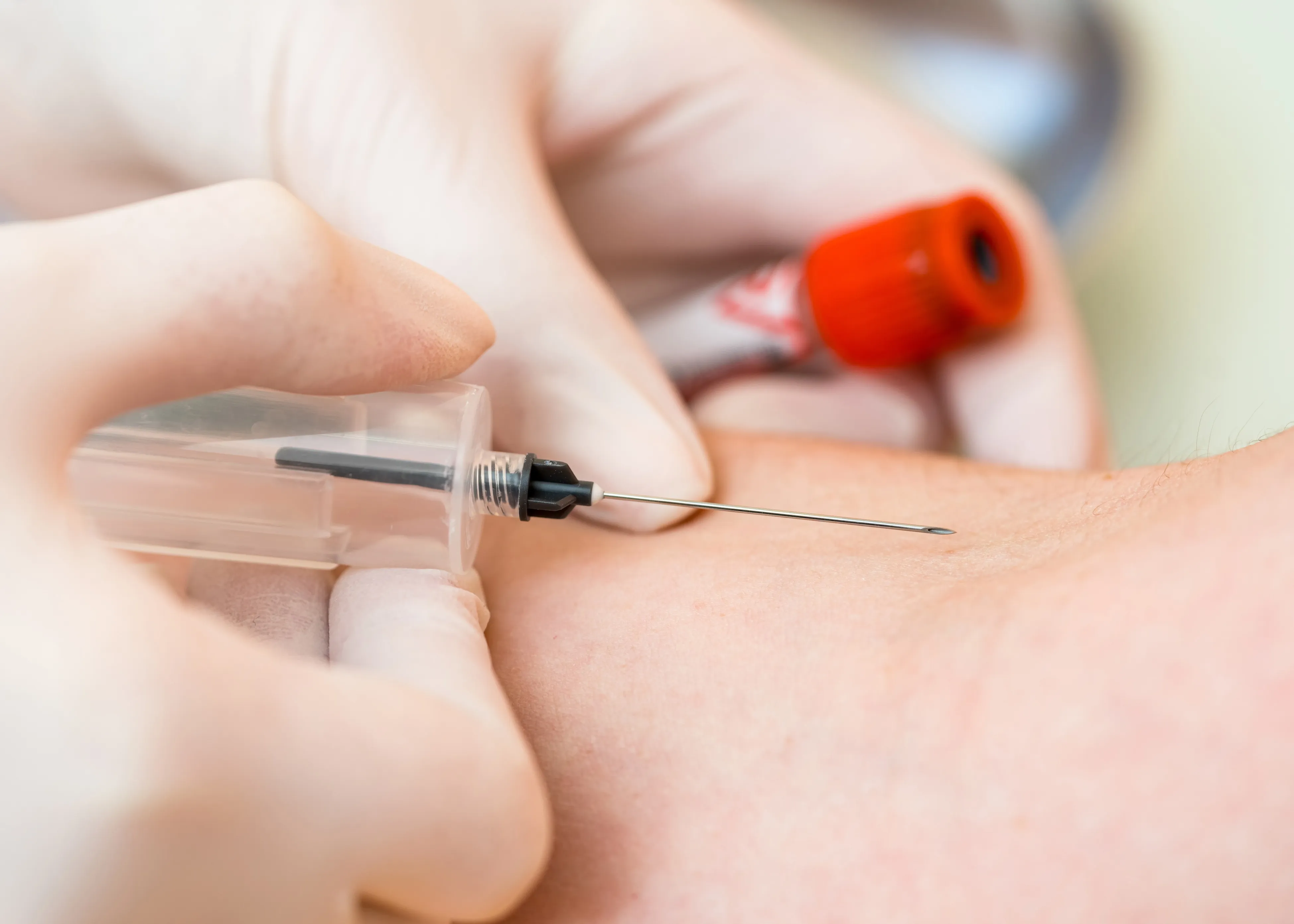 Nutritional Blood Analysis Largo FL