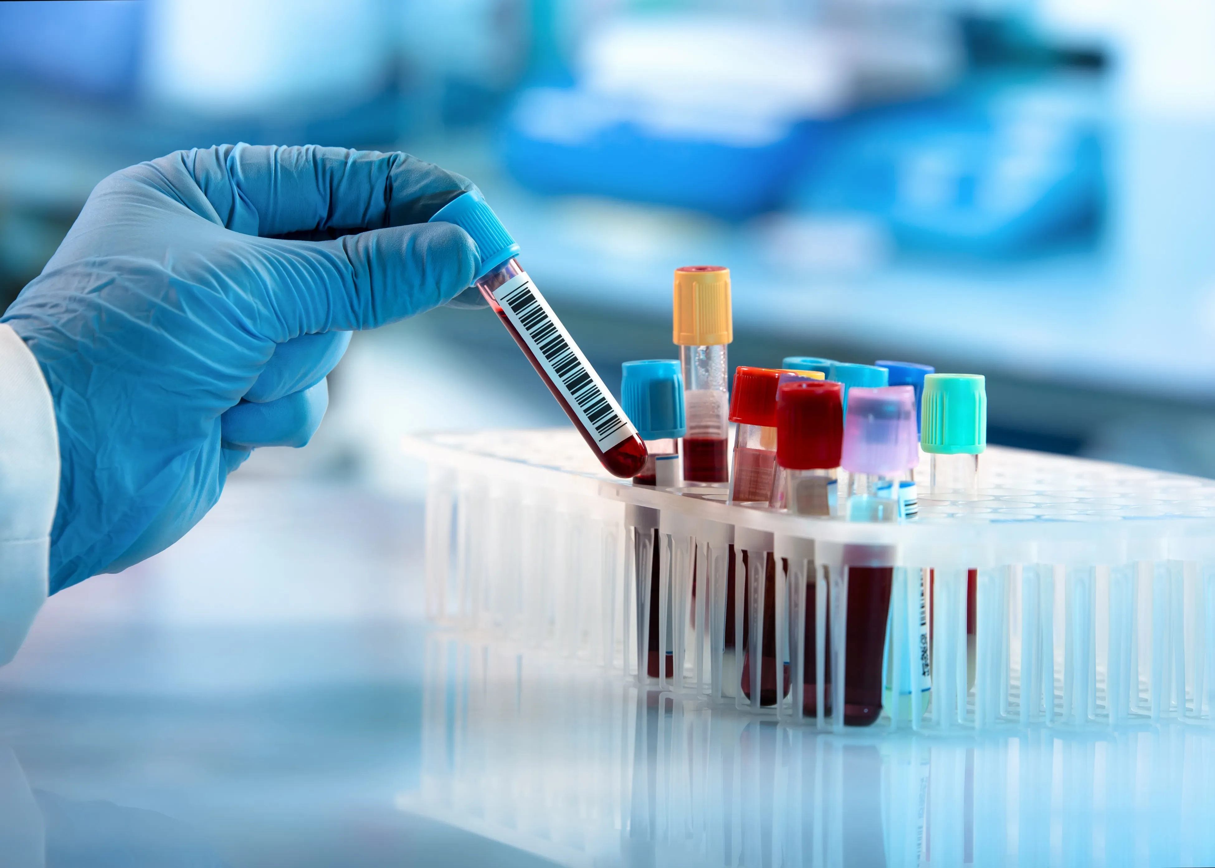 Advanced Medical Lab Testing Largo FL
