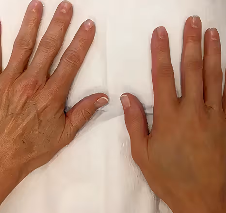 Two hands placed side by side on a white surface, one with lighter skin and visible veins, the other with darker skin tone.