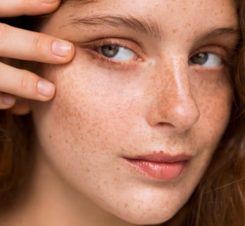 Close-up of a freckled face with blue eyes and fingers gently touching the skin beneath the eye.