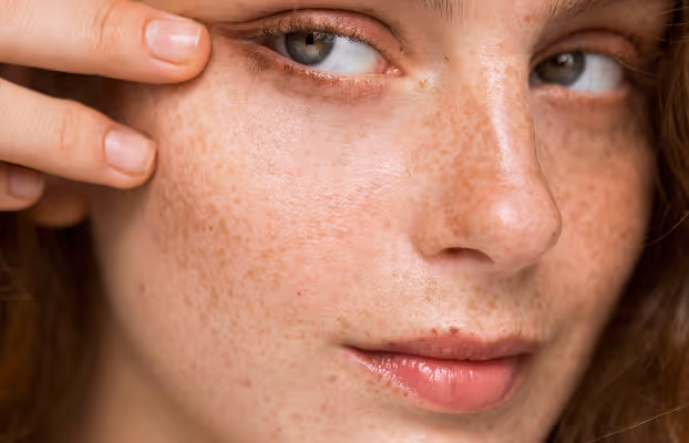Close-up of a woman with freckles touching skin below her eye.