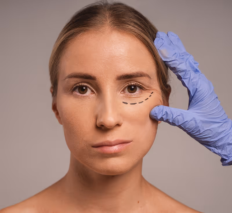 Woman with a marked line under her right eye and a gloved hand touching her cheek.