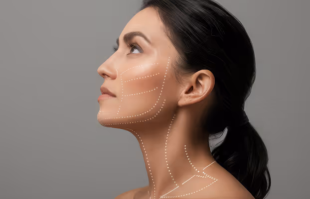 Profile of a woman with dotted lines on face and neck indicating areas for cosmetic treatment.