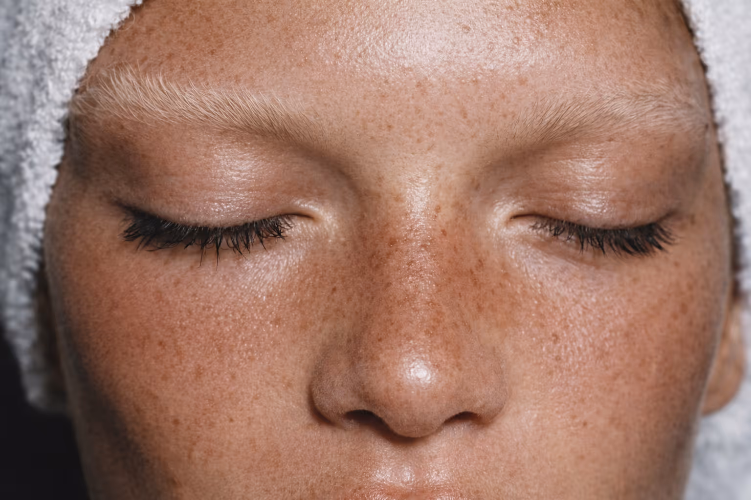 Close-up of freckled skin with closed eyes, showing natural texture and calm skincare moment