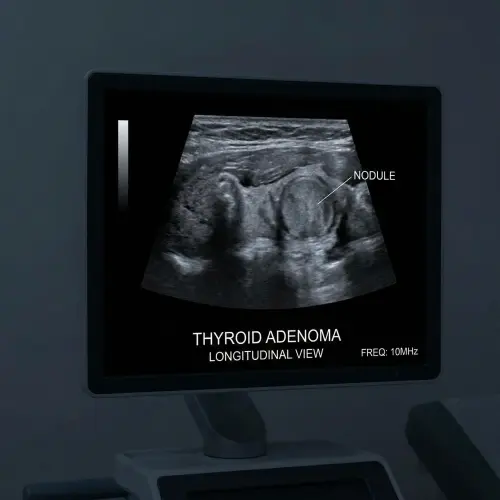 thyroid adenoma night sweats