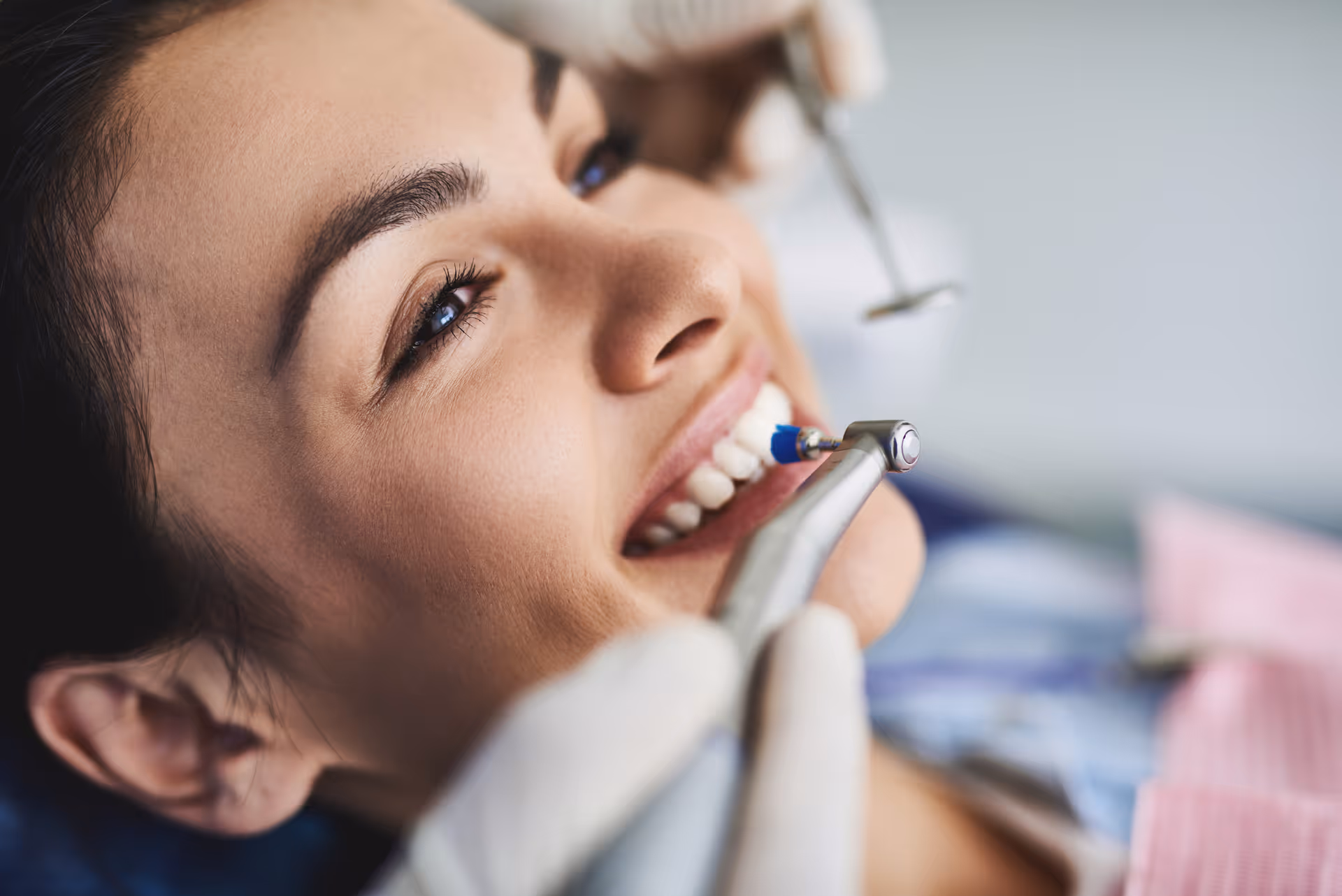 Fluoride Treatment
