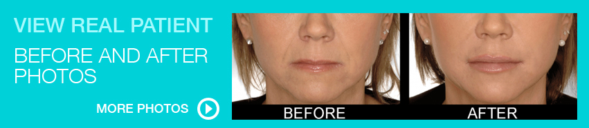 View real patient before and after photos