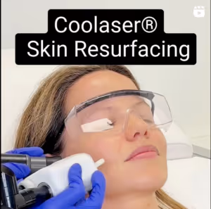 real patient having Coolaser skin resurfacing treatment at Epione