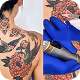 Laser Tattoo Removal