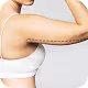 Arm Lift