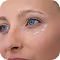 Under Eye Transformation