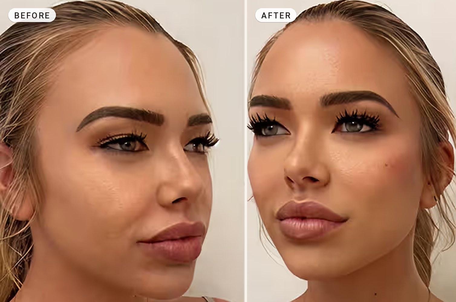 Cheek Contouring 01
