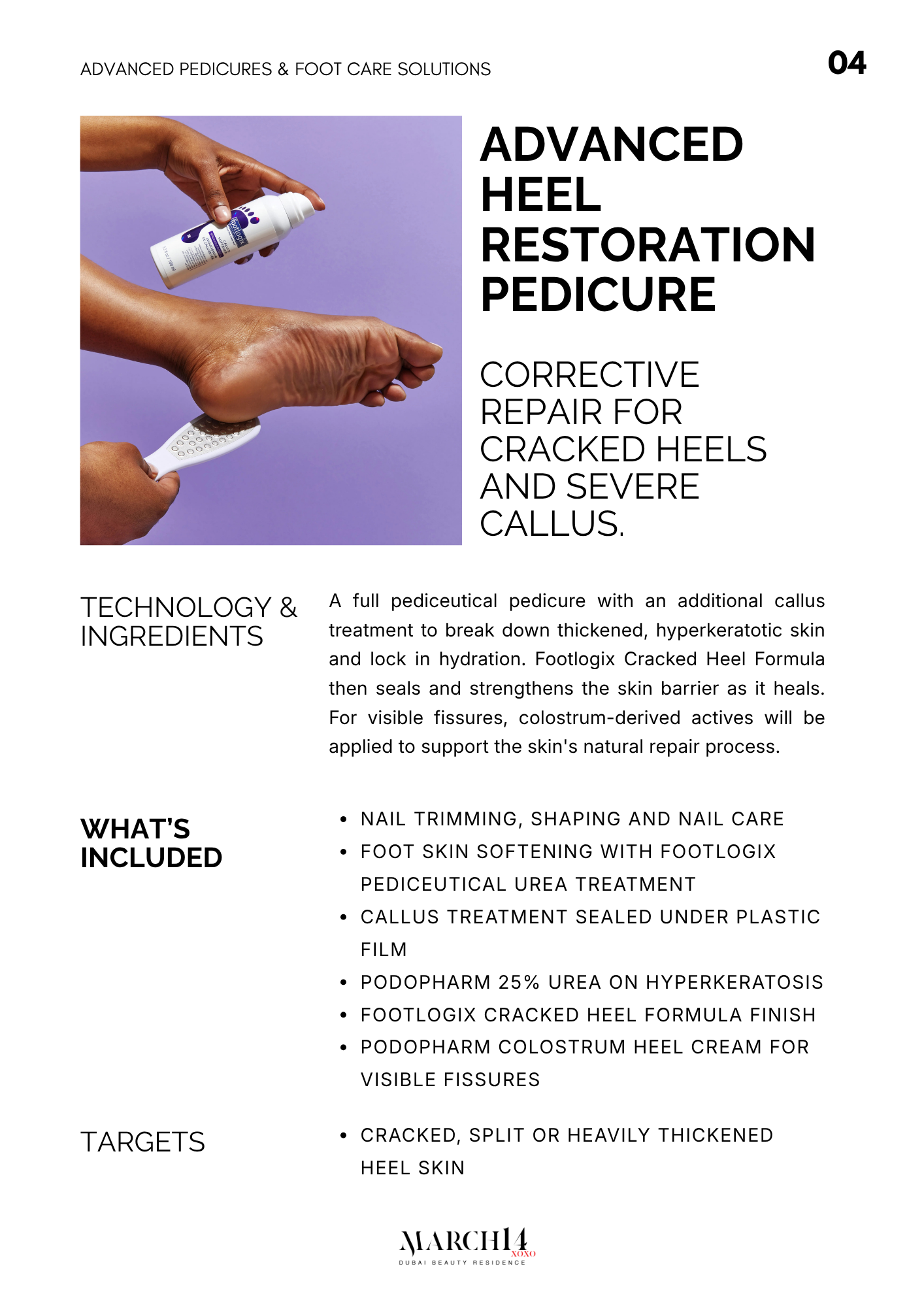 Advanced Heel Restoration Pedicure for cracked heels at March14 Beauty Residence Dubai