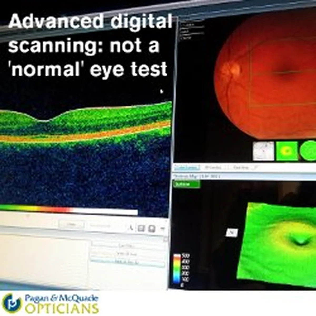 Optical Coherence Tomography and you