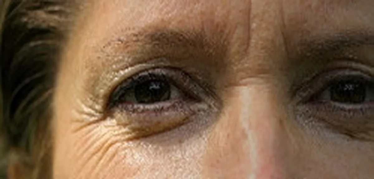 How to prevent crows-feet (and stay young looking)