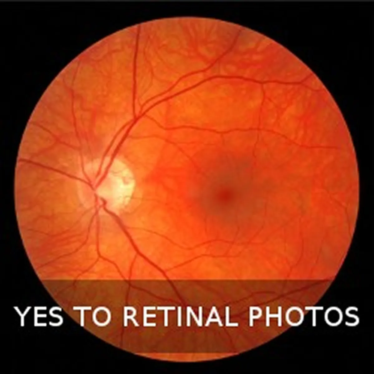 What to say when we ask “Do you want a retinal photograph?”