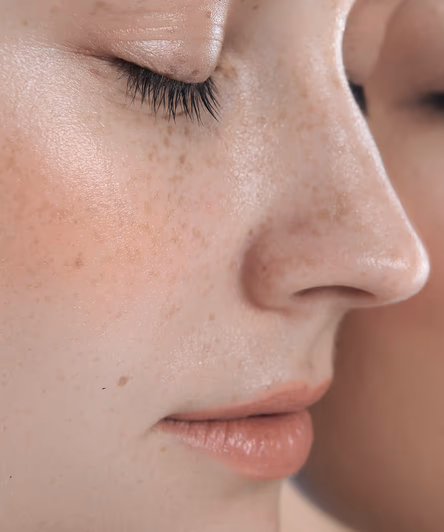 aderma mantu campaign