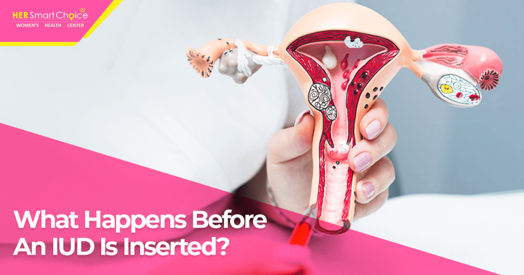 IUD insertion