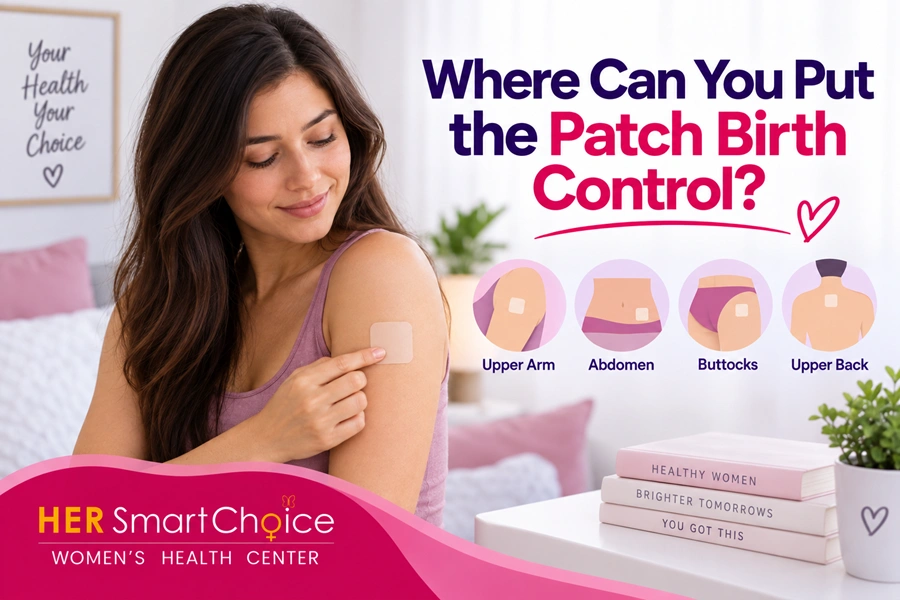 Where Can You Put the Patch Birth Control