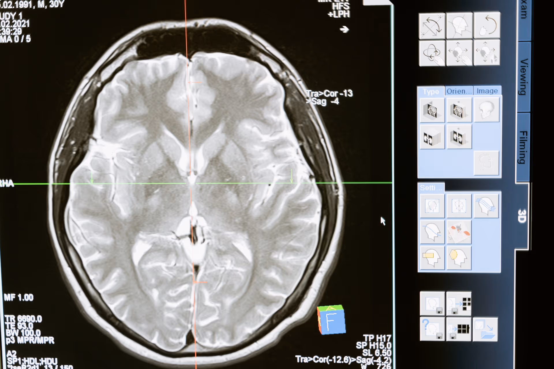 brain scan image