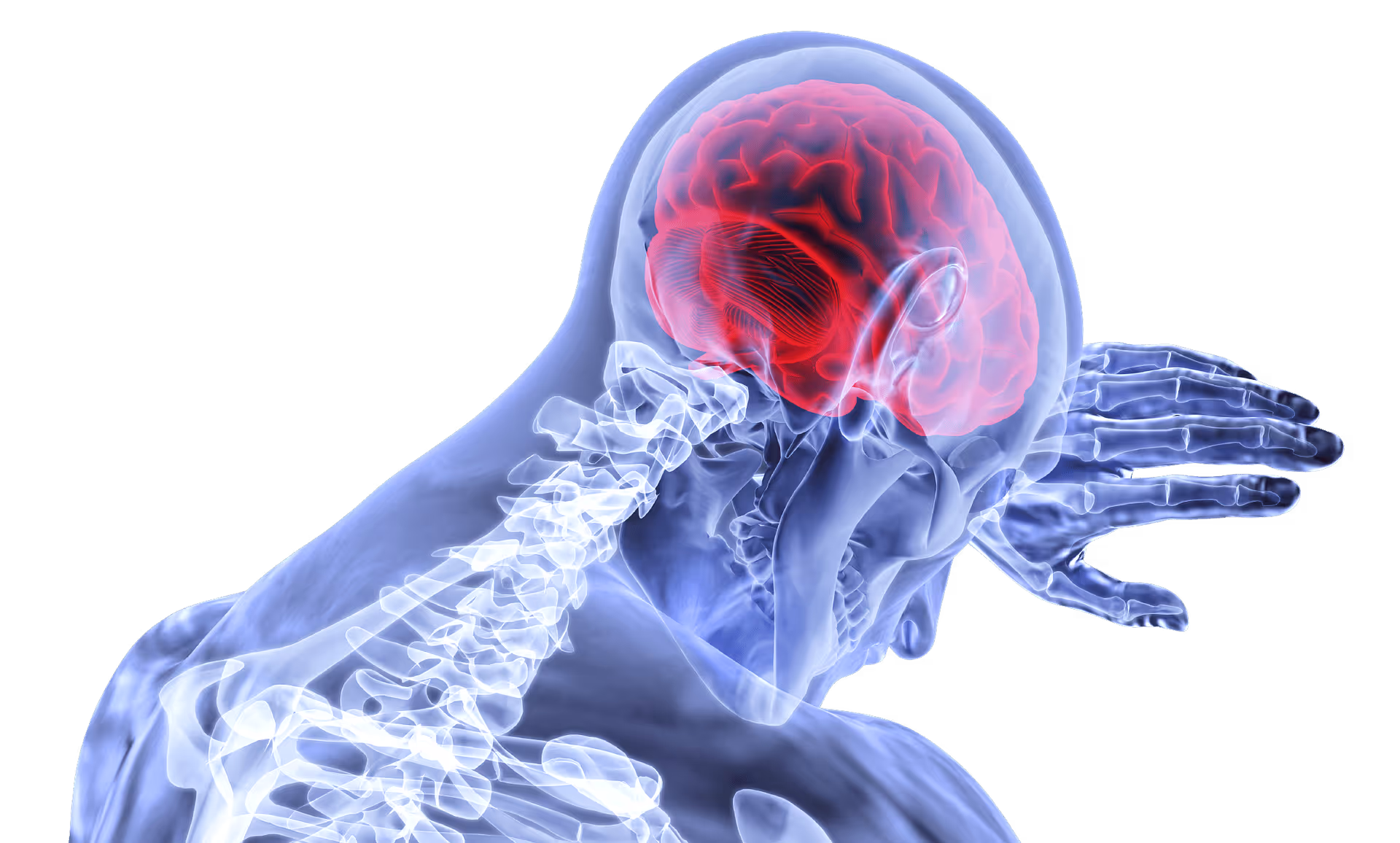 Diffuse Axonal Brain