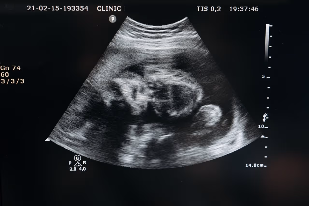 An ultrasound of a baby, looking for abnormalities and birth defects