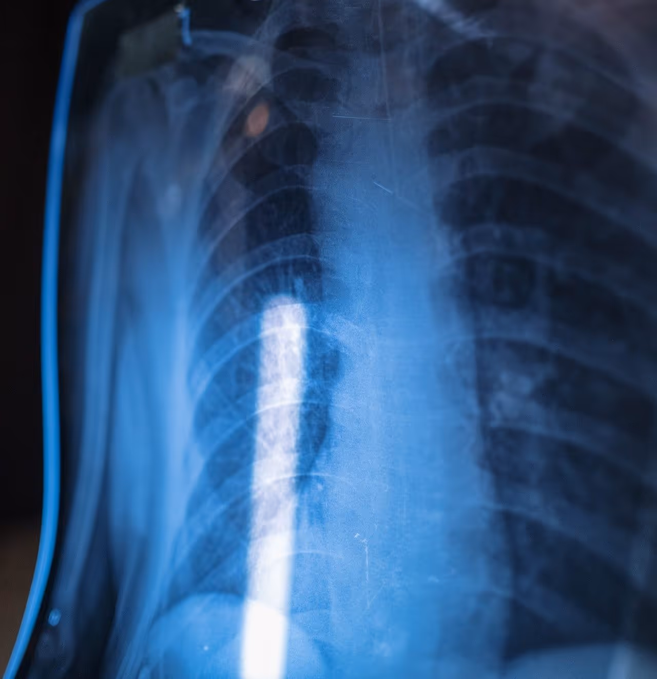 x ray